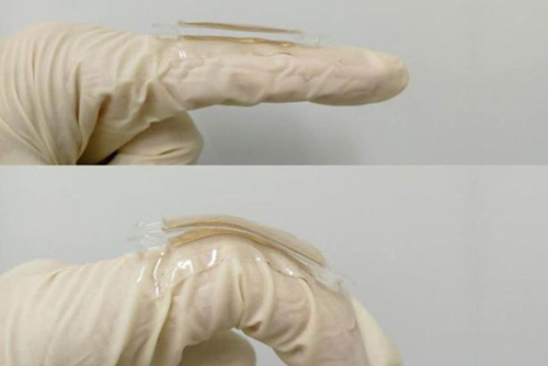 Nhãn kim loại được gắn trên ngón tay người. Ảnh: Mirror.